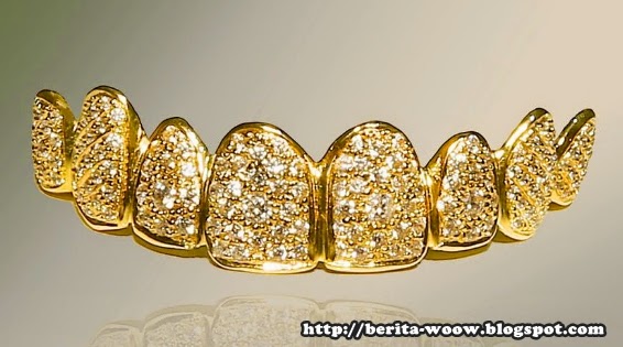 Gigi palsu yang terbuat dari emas murni dan berhiaskan berlian