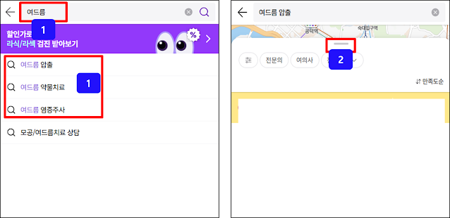 모두닥-홈페이지-여드름-등드름-전문의-피부과-병원-찾기-검색어-입력-선택