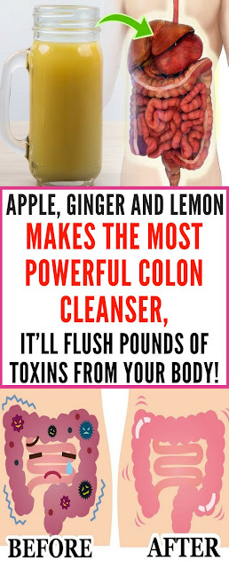 Apple, Ginger And Lemon Makes the Most Powerful Colon Cleanser, It’ll Flush Pounds Of Toxins From Your Body!