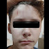 [PHOTOS] Figeac : Nathan est harcelé au collège, son père publie des photos de ses blessures
