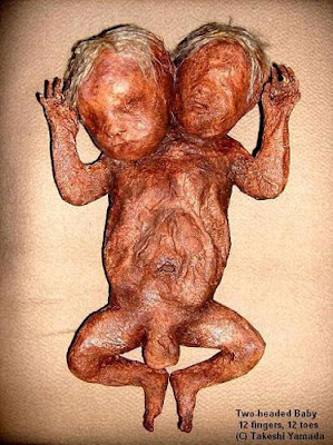 [Image: two-headed-baby.jpg]
