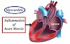 What is Myocarditis? What are Causes, Symptoms? How can Myocarditis be Treated? How can it be prevented?