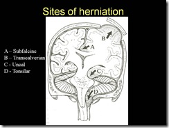 Slide14