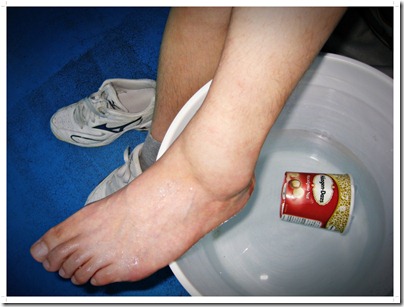 sprain02