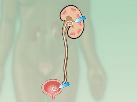 Ureteral Stents Market