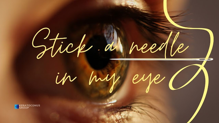 Stick a Needle in My Eye - My Keratoconus Journey