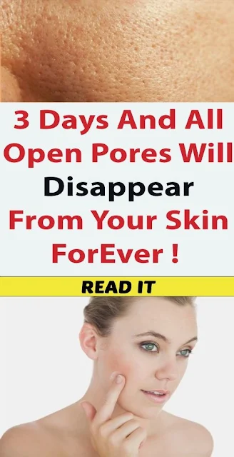 3 Days And All Open Pores Will Disappear From Your Skin Forever