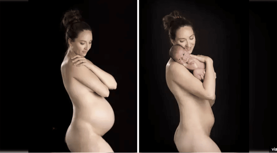 25+ Before & After Pregnancy Pictures That Will Make Your Heart Melt