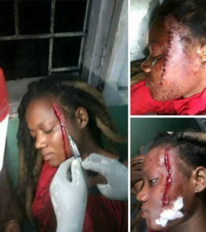 Lady's face disfigured For Sleeping With Her Sister's Husband [Photos]