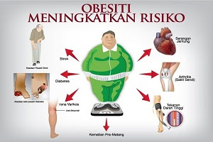 Obesitas sangatlah berbahaya jika terlalu berlebihan.