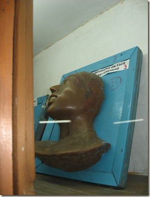 abrasion on face near forehead