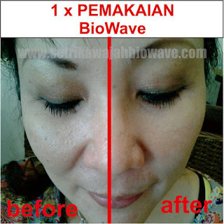 Testimoni Setrika Wajah Biowave Skincare