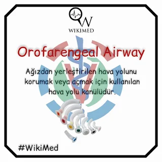 orofarengeal-airway