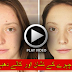 How to Remove Dark Spots From Your Face in 5 Minutes