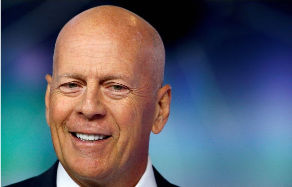 Bruce Willis Has Frontotemporal Dementia His Household Reveals