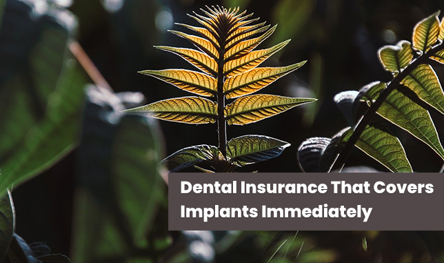 Dental Insurance That Covers Implants Immediately