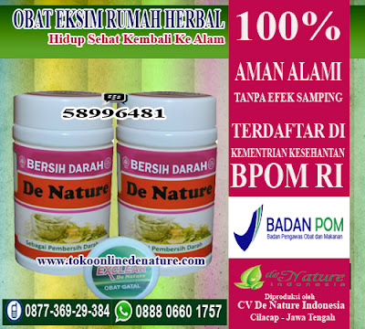 OBAT EKSIM RUMAH HERBAL