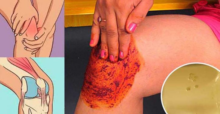 People Love This Recipe That Relieves Knee, Bones And Joints Pain