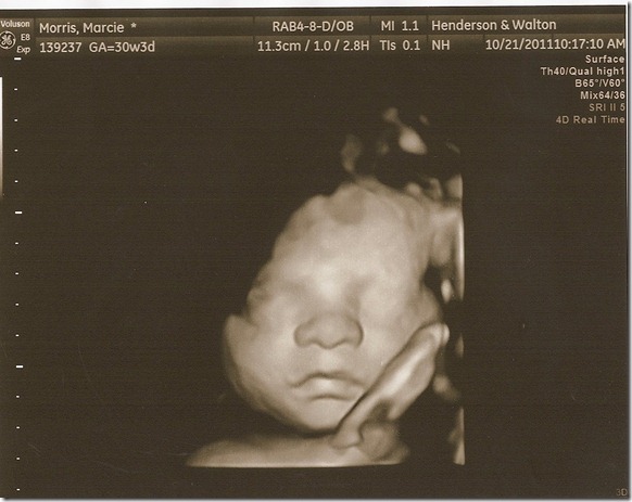 SCAN0093