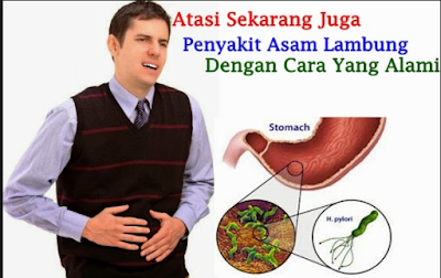 asam lambung