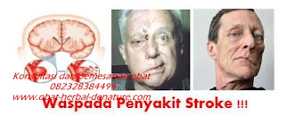 obat stroke herbal,obat herbal stroke,obat stroke denature,obat lumpuh separo,obat stroke ringan,obat stroke berat