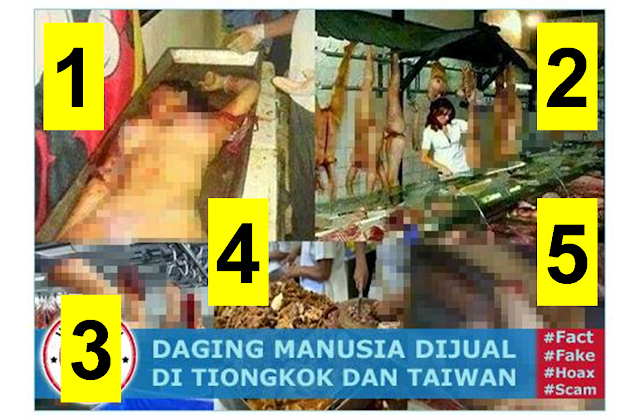 DAGING MANUSIA DI JUAL BEBAS DI TIONGKONG DAN TAIWAN