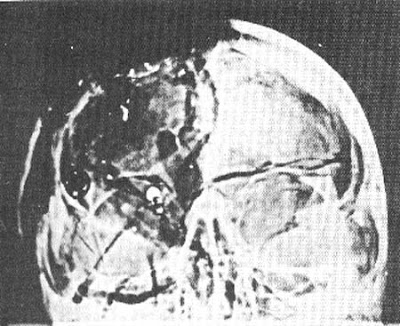 kennedy assassination autopsy pictures. kennedy assassination autopsy