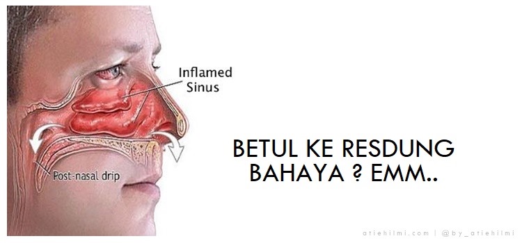 petua_merawat_penyakit_resdung