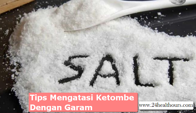 Tips Mengatasi Ketombe Dengan Garam