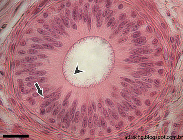 Corte de epidídimo - Tecido epitelial de revestimento pseudo-estratificado prismático com estereocílios