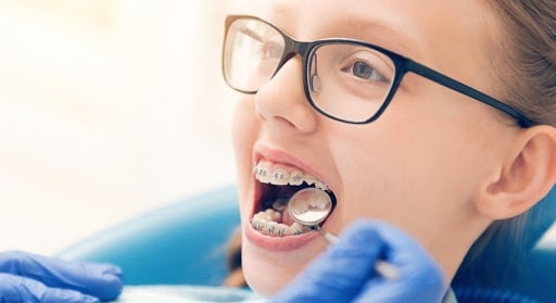 correct child's teeth irregularities kid orthodontist fix crooked smile braces