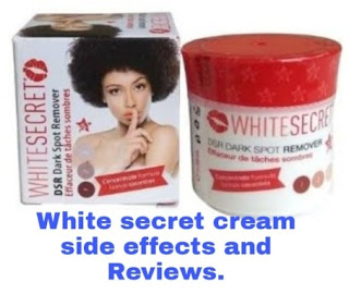 White secret cream side effects