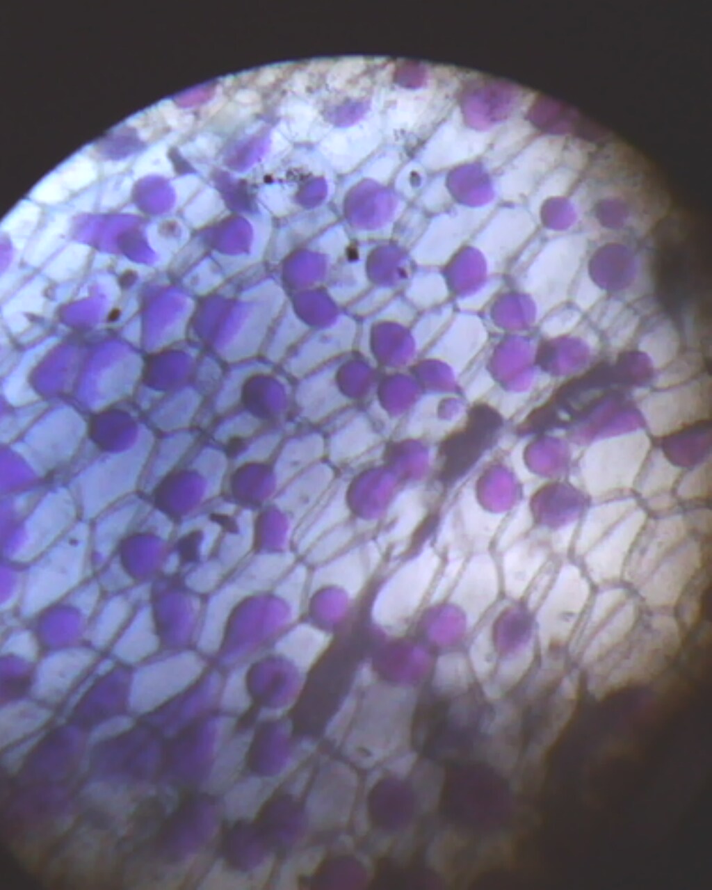  plasmolysis