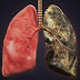 Vaping Additives Harm a Vital Membrane in the Lungs - Study Shows