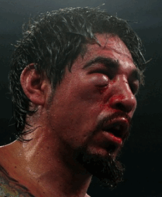 Boxer Antonio Margarito