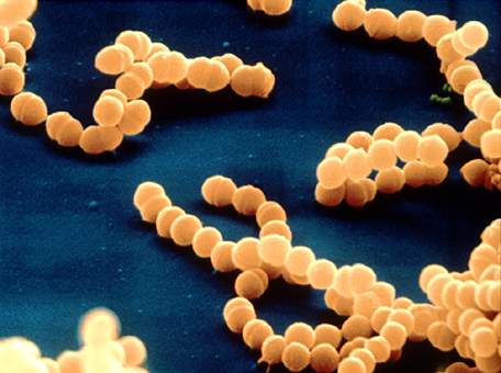 Bacterial Meningitis Bacterial. vary Meningitis+acterial