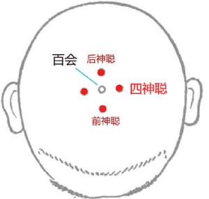 四神聰穴位 | 四神聰穴痛位置 - 穴道按摩經絡圖解 | Source:big5.wiki8.com