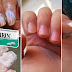 How To Use Aspirin To Grow Nail Very Fast In 2 Days!