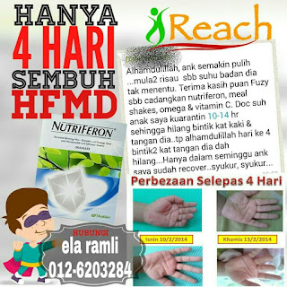 tips atasi penyakit hfmd