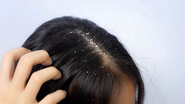 HOW TO STOP HAIR FALL