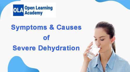Severe Dehydration in Children and Adults - Symptoms & Causes