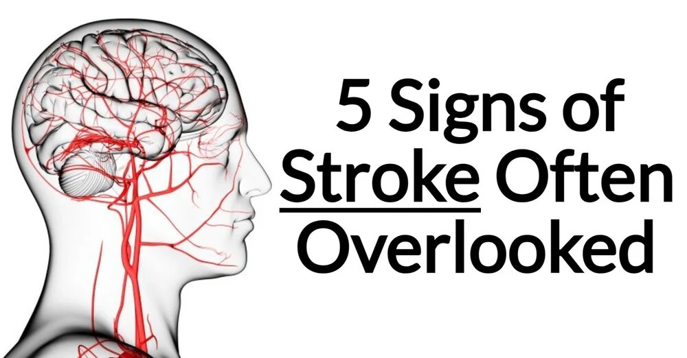 5 Signs of Stroke Often Overlooked
