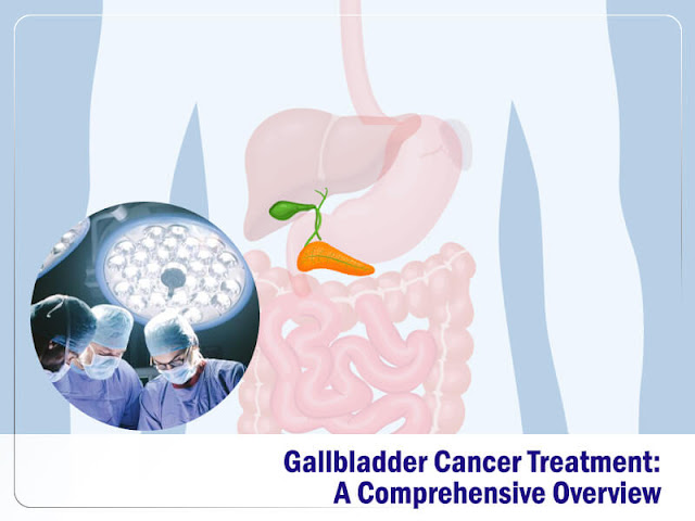 gallbladder cancer treatment