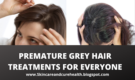 Premature Gray Hair Treatments For Everyone | Greying of Hair in Early Age | White Hair Treatments Of All Age