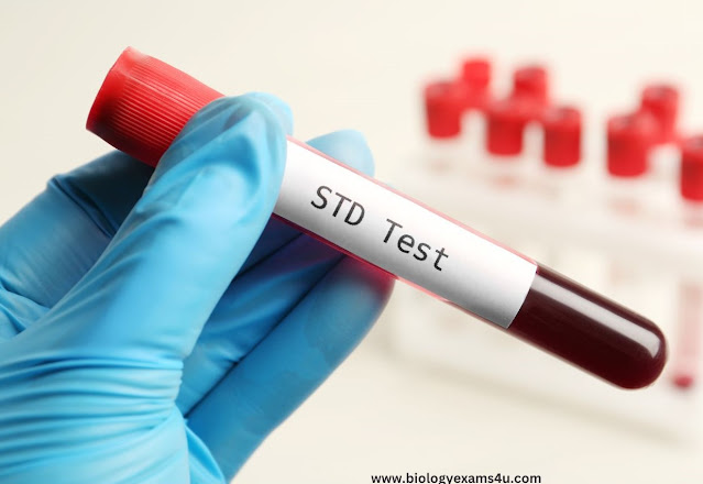 Sexually Transmitted Diseases (STD) | Venereal diseases - AIDS, Syphilis, Gonorrhoea