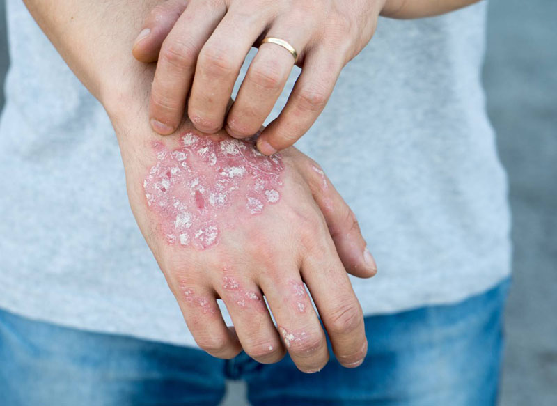  13 Weird Skin Spots You Should Definitely Get Checked Out