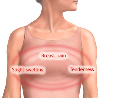 What is Mastodynia - Definition, Symptoms, Causes, Treatment