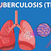 What Is Tuberculosis | Latent TB infection | Tuberculosis Treatment and Prevention