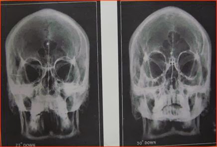 MATERI RADIOLOGI: PERBEDAAN RONTGEN,CT DAN MRI