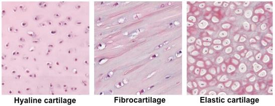 perbedaan tulang rawan hialin elastik dan fibroblas